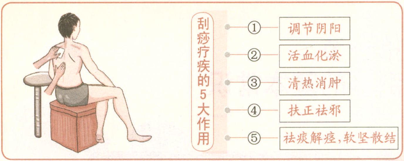 刮痧，中醫(yī)療治六法之首